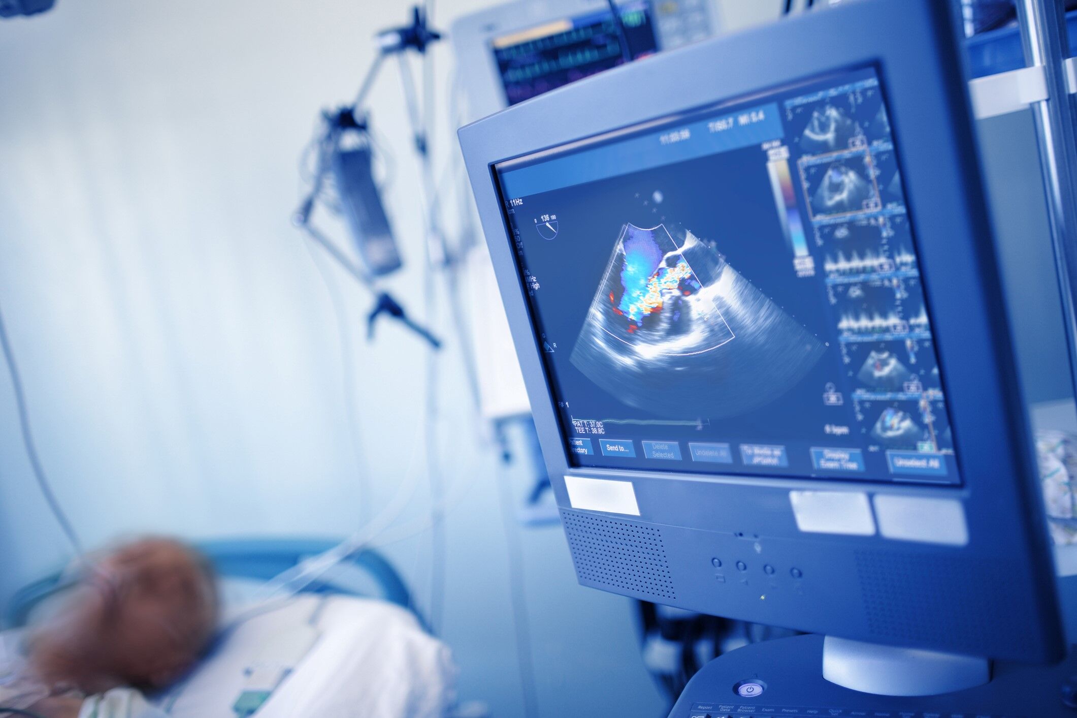 Cardiac Sonography Associate of Applied Science (AAS) Degree Program